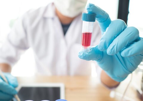 ”Stärk medicinsk forskning och utveckling inför nästa hälsokris”