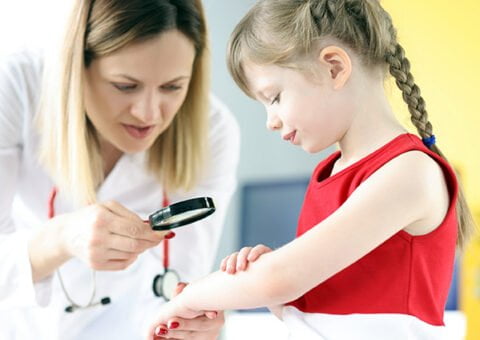 Barn med eksem3_600x424