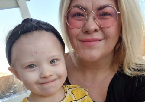 Lo lever med svår björkpollenallergi.